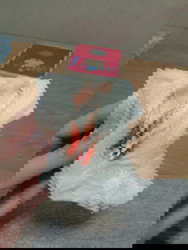 ตรวจปากมดลูกแล้วเลือดออก