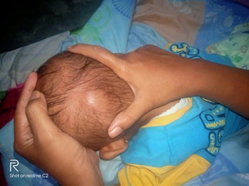 Bun mau nanya dong anak saya di kepala nya ada benjolan kaya di gambar kira kira berbahaya kah bun
