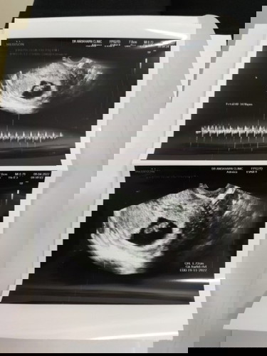 เจอแล้วววว