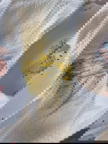 ลูกถ่ายเป็นน้ำสีเขียวมีฟองมีกลิ่นคาว