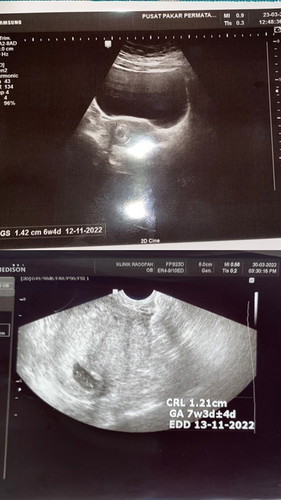 Anak mama 🤍 الفاتحة