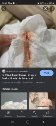 Bloody mucus discharge