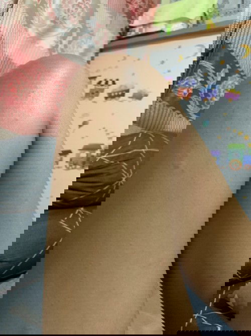 เป็นผื่นหลังคลอดได้7วัน