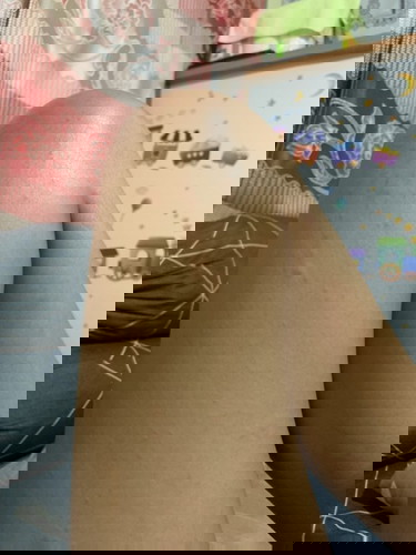 เป็นผื่นหลังคลอดได้7วัน