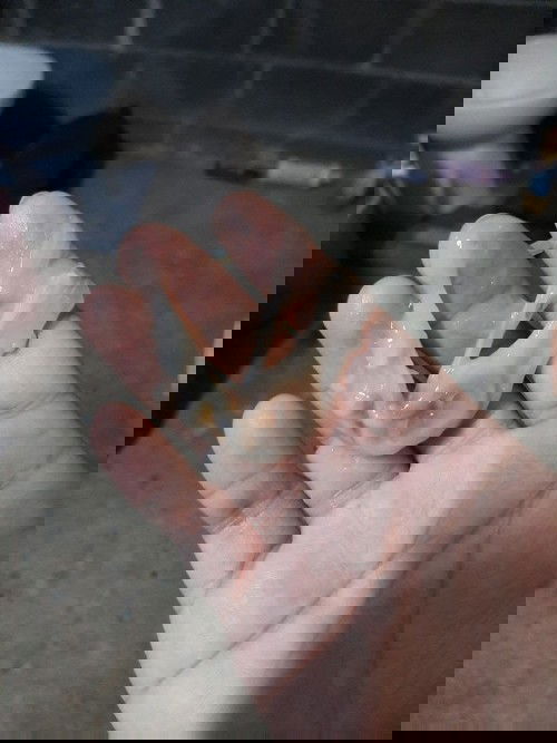 รบกวนแม่ๆที่มีอาการคล้ายๆกันช่วยแนะนำทีค่ะ