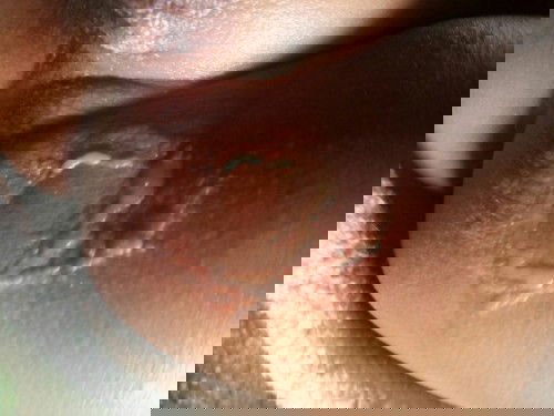 ada yang tau obatnya