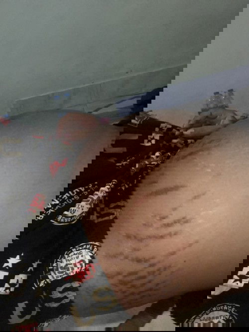 อยากจะสอบถามเรื่องแตกลายค่ะ