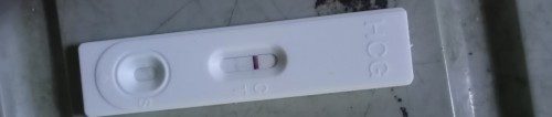 PCOS BOTH OVARIES