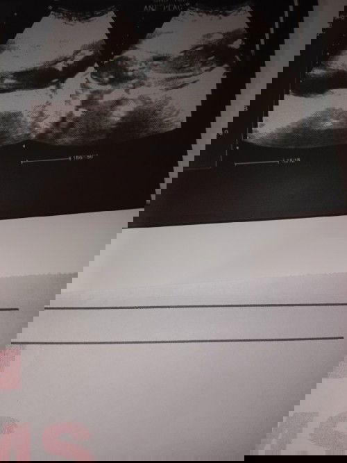 Advice lang po..16weeks and 5days si baby..excited po lang..pang apat na po na pag bubuntis......🥰