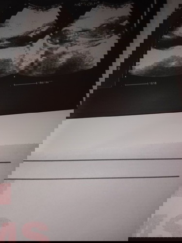 Advice lang po..16weeks and 5days si baby..excited po lang..pang apat na po na pag bubuntis......🥰