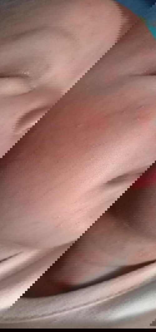 bintik merah di wajah dan kepala