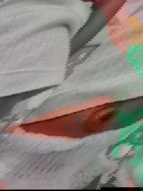 Pusar menonjol keluar