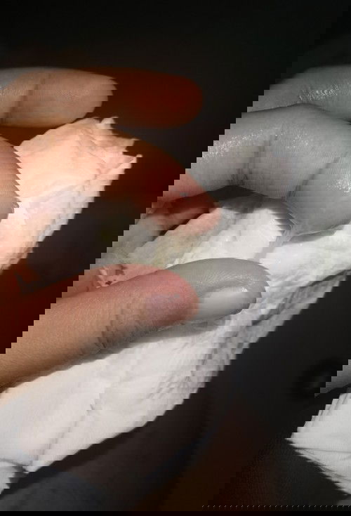 Pasintabi po. Sipon na discharge