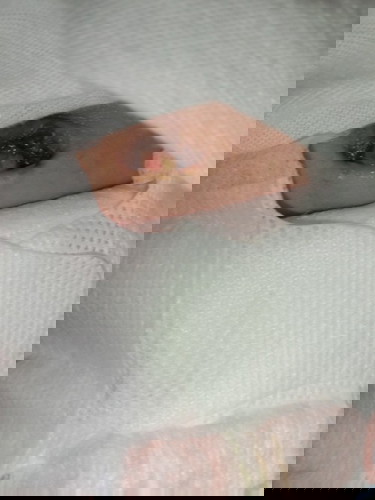 Umbilical cord