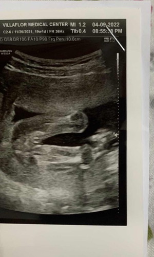 Boy or Girl