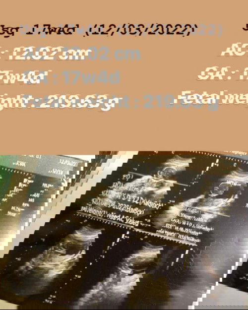 Panjang janin pd hasil USG