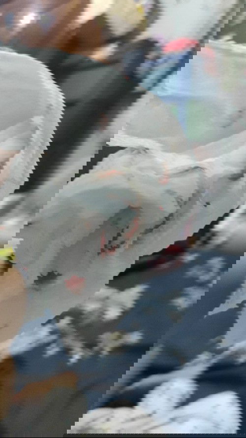 Baby 10 bulan mimisan