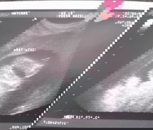 19 weeks gender scan