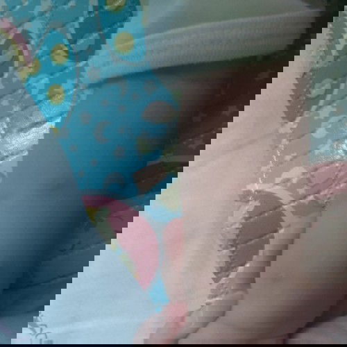 Cara menghilangkan bekas gigitan nyamuk