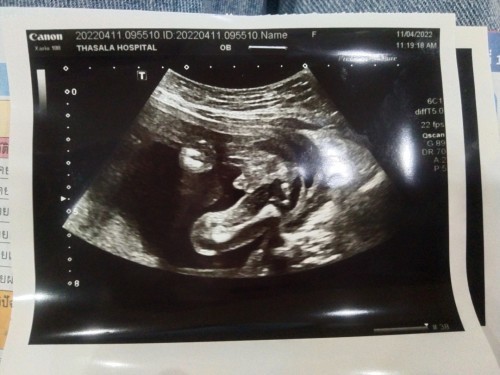 ช่วยกันดูหน่อยค่ะ