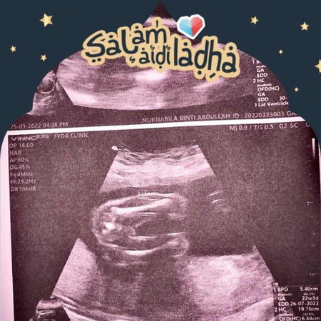 Boy ke girls🥲,saya pertama kli buat detil scan.,korang pndai tk tgok gmbr scan ni?saya tk berapa reti nk tgok🥲