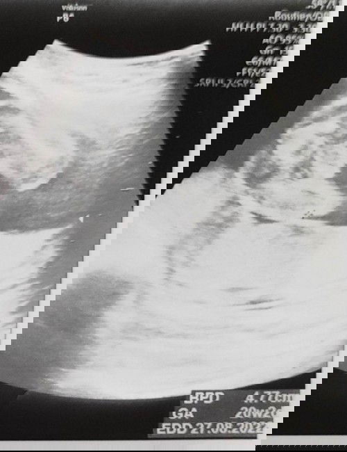 เด็กผู้ชายใช่ไหมคะ?