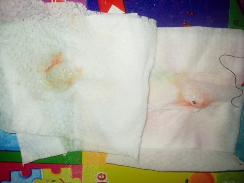 ขอคำแนะนำหน่อยค่ะ