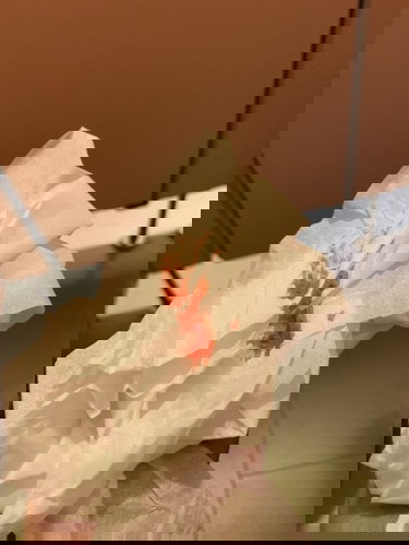 อึเเข็งจนมีเลือดออกอันตรายไหม