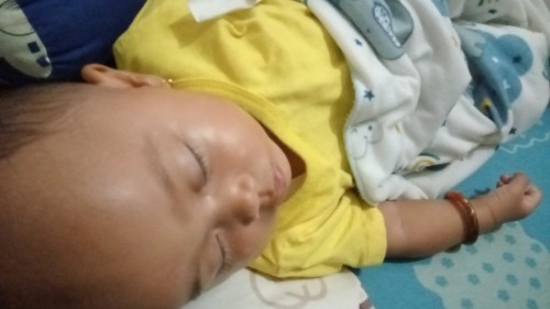 Cara mengatasi ruam susu pada wajah bayi mom ( bintik putih ) ?