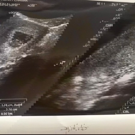 8 weeks share pengalaman