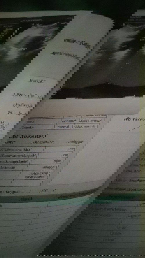 Hancur harus mengalami keguguran