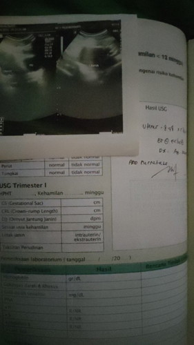 Hancur harus mengalami keguguran