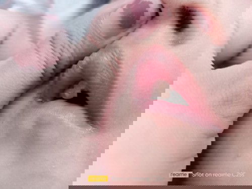 3YEARS OLD TOOTHACHE