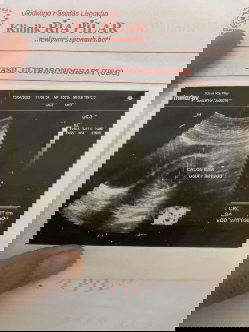 Bedrest Total kehamilan 7minggu3hari