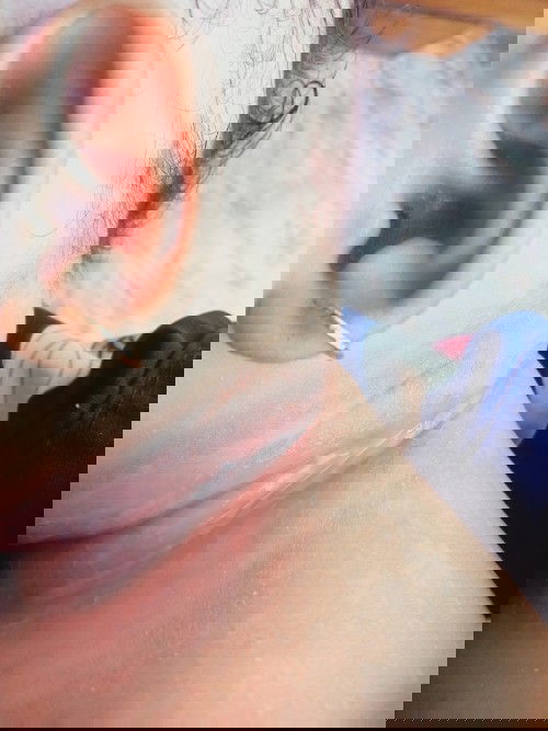 Leher anak saya kenapa ya Bun?