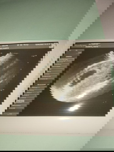 Taqdir Allah pasti yang terbaik, Penantian 5 tahun