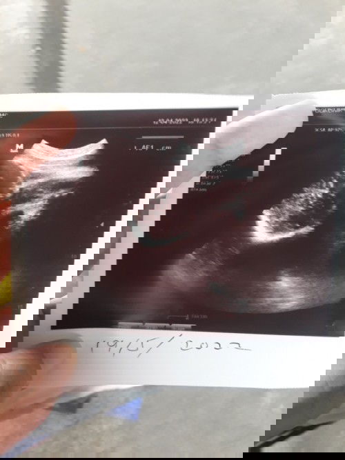 Boleh tnya ka btul ke dlam scan nii bby kpala atas btul ka bby nii bby boy sya bingung jantina nya