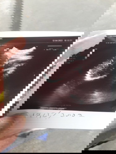 Boleh tnya ka btul ke dlam scan nii bby kpala atas btul ka bby nii bby boy sya bingung jantina nya