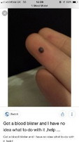 Blood blister kat private part