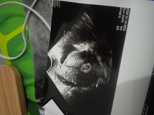 Hamil tapi tespek samar