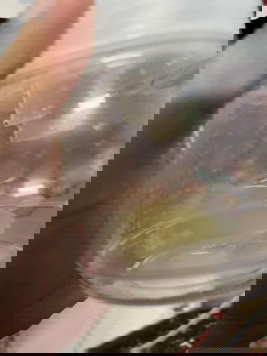 Inverted nipple & susu