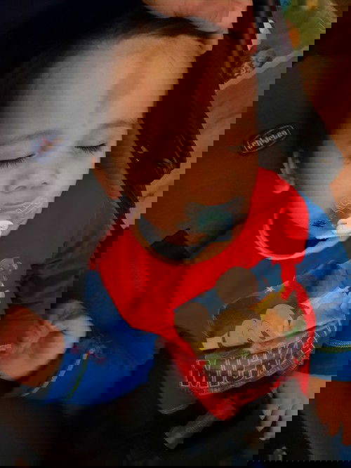 Bakit inuuntog ulo nila or pinapalo?