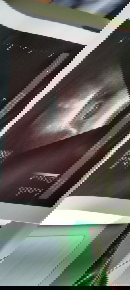 Maaf jorok ya Bun..🙏 yang gak mau liat jangan dipencet.🙏