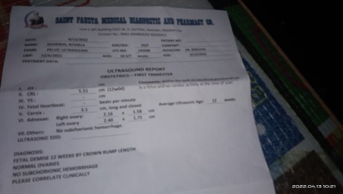 3months no heart beat