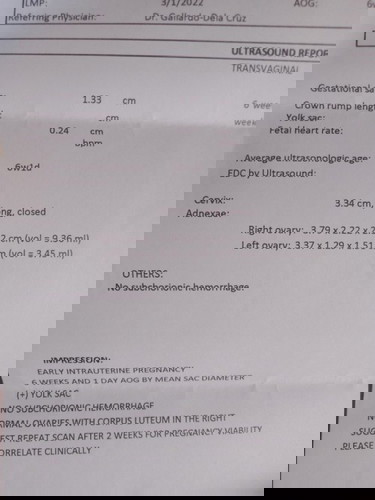 6weeks and 1day Sac palang nakita