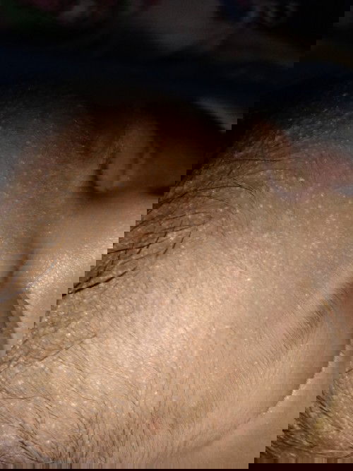 Bintik-bintik di dahi apa obatnya?