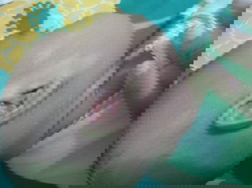 Kulit putih" Seperti panu