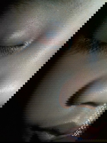 My parang bukol sa talukap ng mata ng anak ko anu kaya un? Slamat po sa sasagot