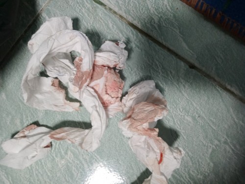 สอบถามแม่ๆค่ะ มีใครเคยมีเพศสัมพันธ์กับแฟนตอน ายุครรภ์ 23wบ้างค่ะ คือเรามีอะไรกันเสร็จแล้วมีเลือดไหลอ