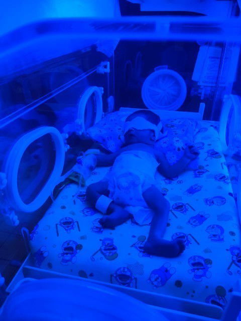 Info kontak peminjaman inkubator & alat fototerapi untuk bunda yang memiliki bayi kuning
